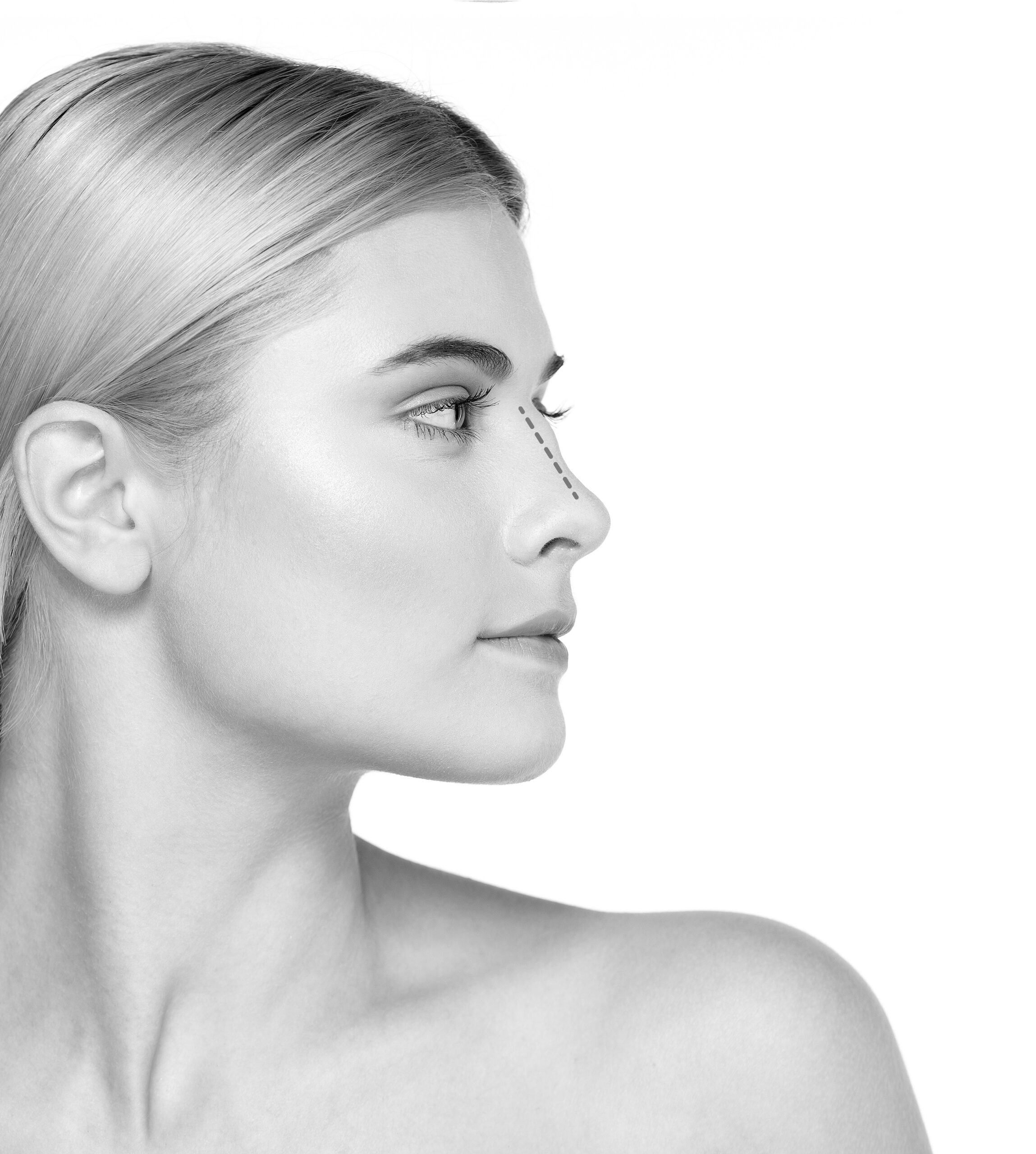 До процедуры